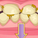 Bad Teeth Makeover